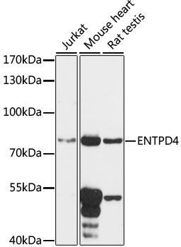 ENTPD4 antibody