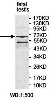 ENTPD4 Rabbit Polyclonal Antibody