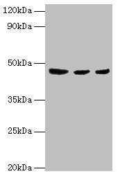 ENTPD5 antibody