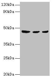 ENTPD5 Antibody