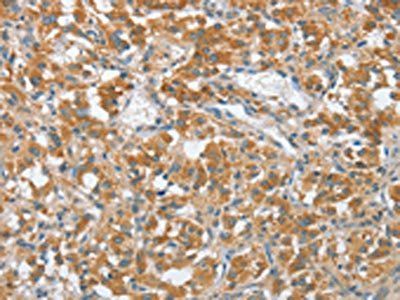 ENTPD5 Antibody