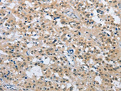 ENTPD5 Antibody