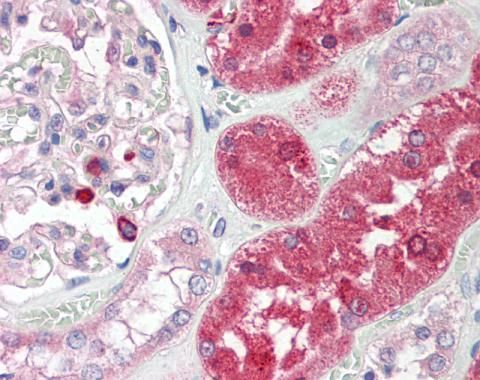 ENTPD5 antibody [N1N3]
