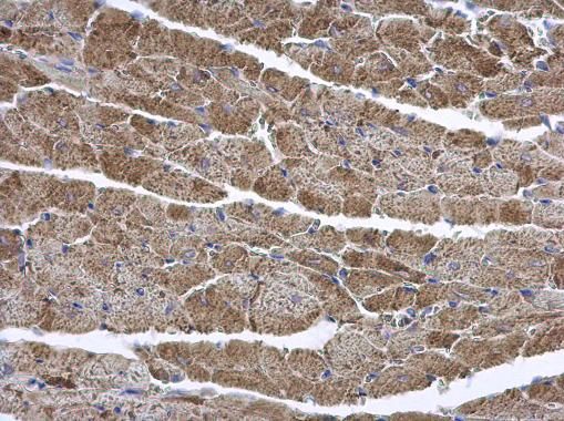 ENTPD6 antibody [N1C1]
