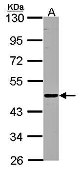 ENTPD6(CD39L2) antibody