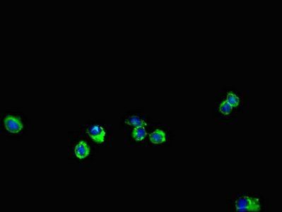 ENTPD7 Antibody