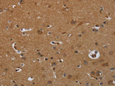 ENTPD7 Antibody