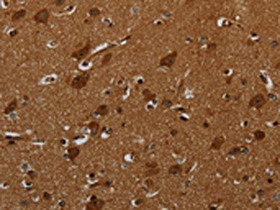 ENTPD7 Antibody
