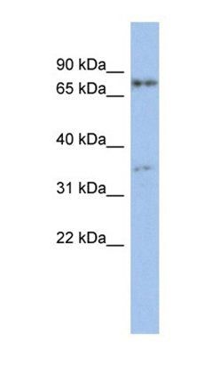 EOMES antibody