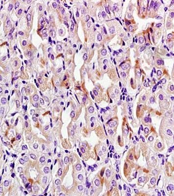 Eotaxin 2 antibody