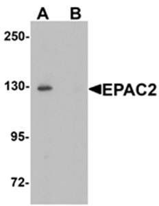 EPAC2 Antibody