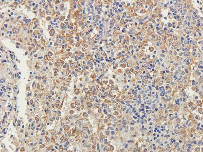 EPAS1 antibody