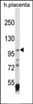 EPAS1 antibody
