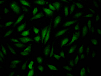 EPAS1 Recombinant Monoclonal Antibody