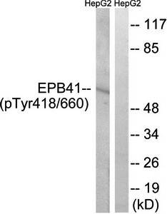 EPB41 (Phospho-Tyr660/418) Antibody