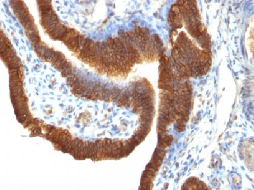 EpCAM antibody