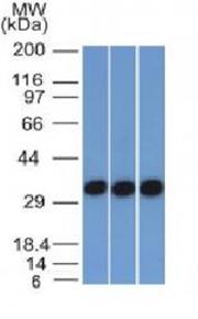 Ep-CAM / CD326 (Extracellular Domain) (Epithelial Marker) Antibody