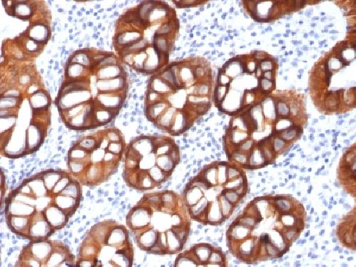 Recombinant EpCAM / CD326 (Epithelial Marker) Antibody