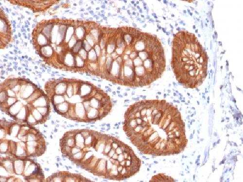 Recombinant Ep-CAM / CD326 (Extracellular Domain) (Epithelial Marker) Antibody