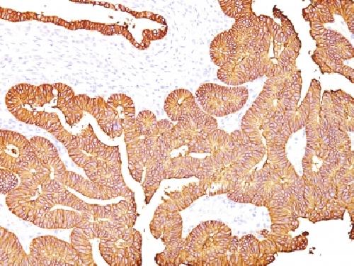 EpCAM / CD326 (Epithelial Marker) Antibody