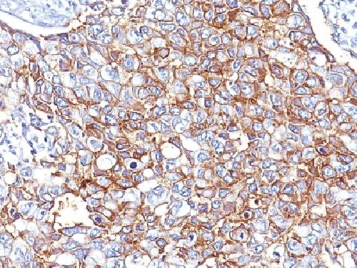 Ep-CAM / CD326 (Extracellular Domain) (Epithelial Marker) Antibody