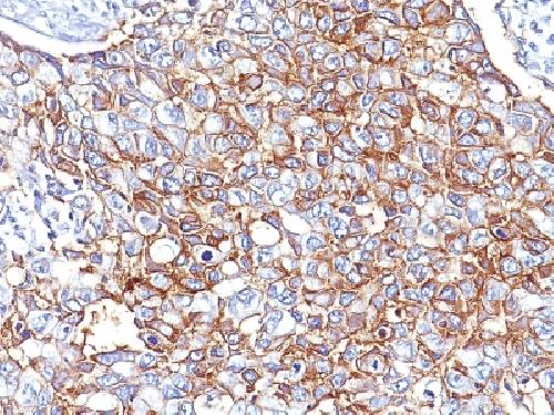 EpCAM / CD326 (Epithelial Marker) Antibody