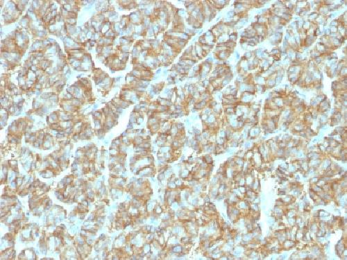 EpCAM antibody