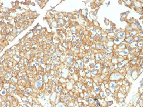 EpCAM / CD326 (Epithelial Marker) Antibody