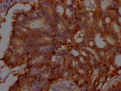 EPCAM Recombinant Monoclonal Antibody