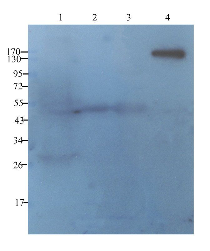 EpCAM antibody