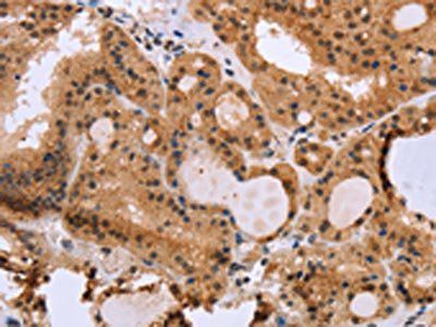 EPDR1 antibody