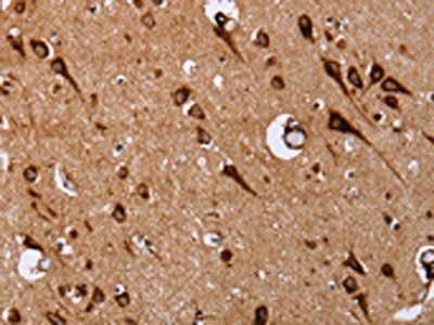 EPDR1 Antibody
