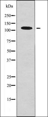 EPH B1/3/4 (Phospho-Tyr778/792/774) antibody