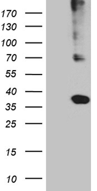 Eph receptor A1 (EPHA1) antibody