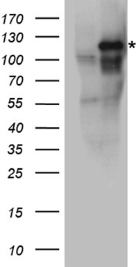 Eph receptor A3 (EPHA3) antibody