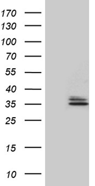 Eph receptor A6 Antibody