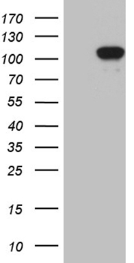 Eph receptor A6 (EPHA6) antibody