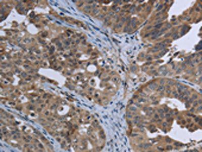 EPHA10 Antibody