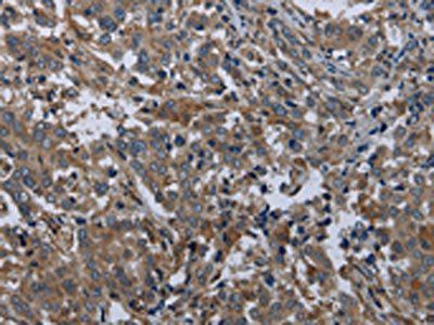EPHA10 Antibody