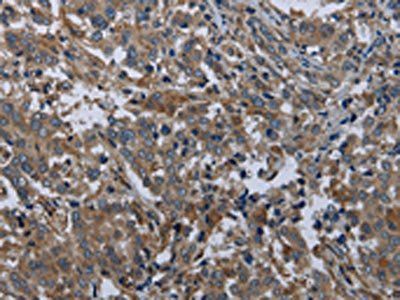 EPHA10 antibody