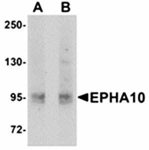 EphA10 Antibody