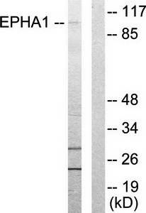 EPHA1 antibody