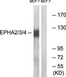EPHA2/3/4 (Ab-588/596) Antibody
