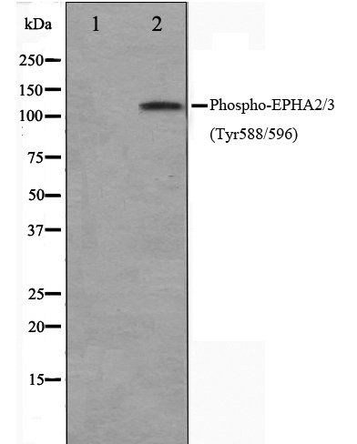 EPHA2/3 (Phospho-Tyr588/596) antibody