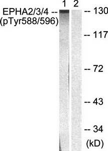 EPHA2/3 (phospho-Tyr588/596) antibody