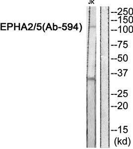 EPHA2/5 (Ab-594) Antibody
