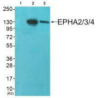 EPHA2/EPHA3/EPHA4 (Ab-588/596) Antibody