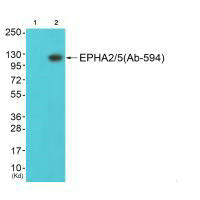 EPHA2 (Ab-594) antibody