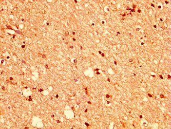 EPHA2 Antibody