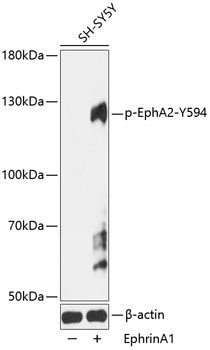 EphA2 (Phospho-Y594) antibody